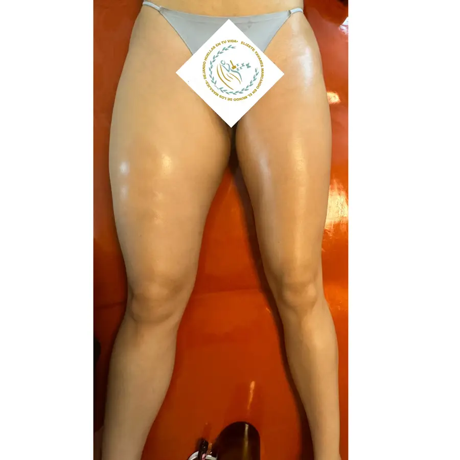 Resultado de tratamiento corporal, imagen 11 (sin identificar a la persona)
