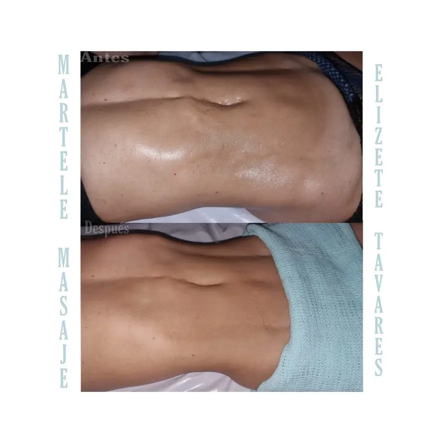 Resultado de tratamiento corporal, imagen 17 (sin identificar a la persona)