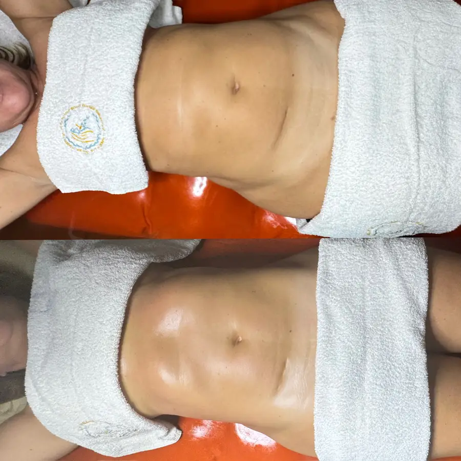 Resultado de tratamiento corporal, imagen 25 (sin identificar a la persona)