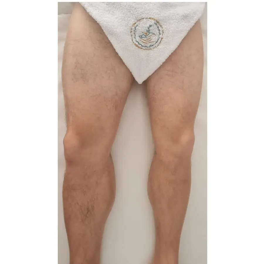Resultado de tratamiento corporal, imagen 26 (sin identificar a la persona)