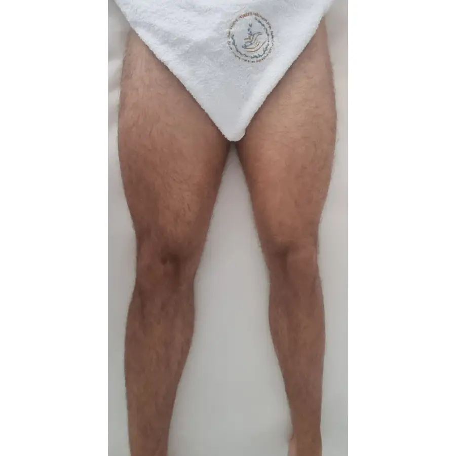 Resultado de tratamiento corporal, imagen 39 (sin identificar a la persona)